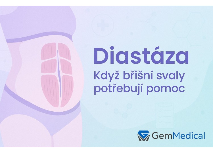 Diastáza u žen i mužů: Jak poznat problém a co zabírá